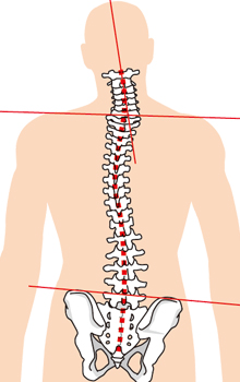 骨盤の関節の機能異常とは